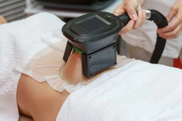 Image of person having fat freezing treatment to help weight gain West Malling