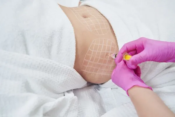 image of fat dissolving injections on love handles to help combat weight gain West Malling